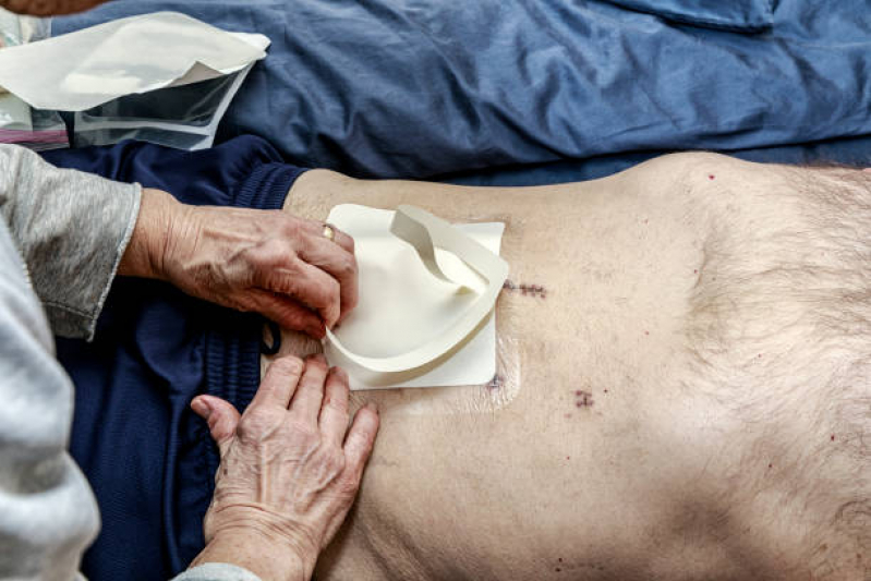 Onde Tem Cuidador de Pessoas no Pós Cirúrgico Lençóis Paulista - Cuidador de Pós Operatório